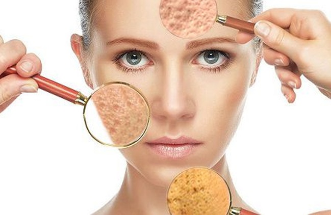 Tổng hợp các cách trị sẹo lõm lâu năm bằng phương pháp tự nhiên siêu hiệu quả