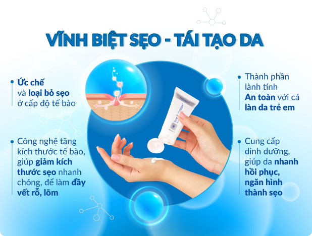 Vĩnh biệt sẹo, tái tạo da với kem làm mờ sẹo Scar Esthetique  Vĩnh biệt sẹo, tái tạo da với kem làm mờ sẹo Scar Esthetique