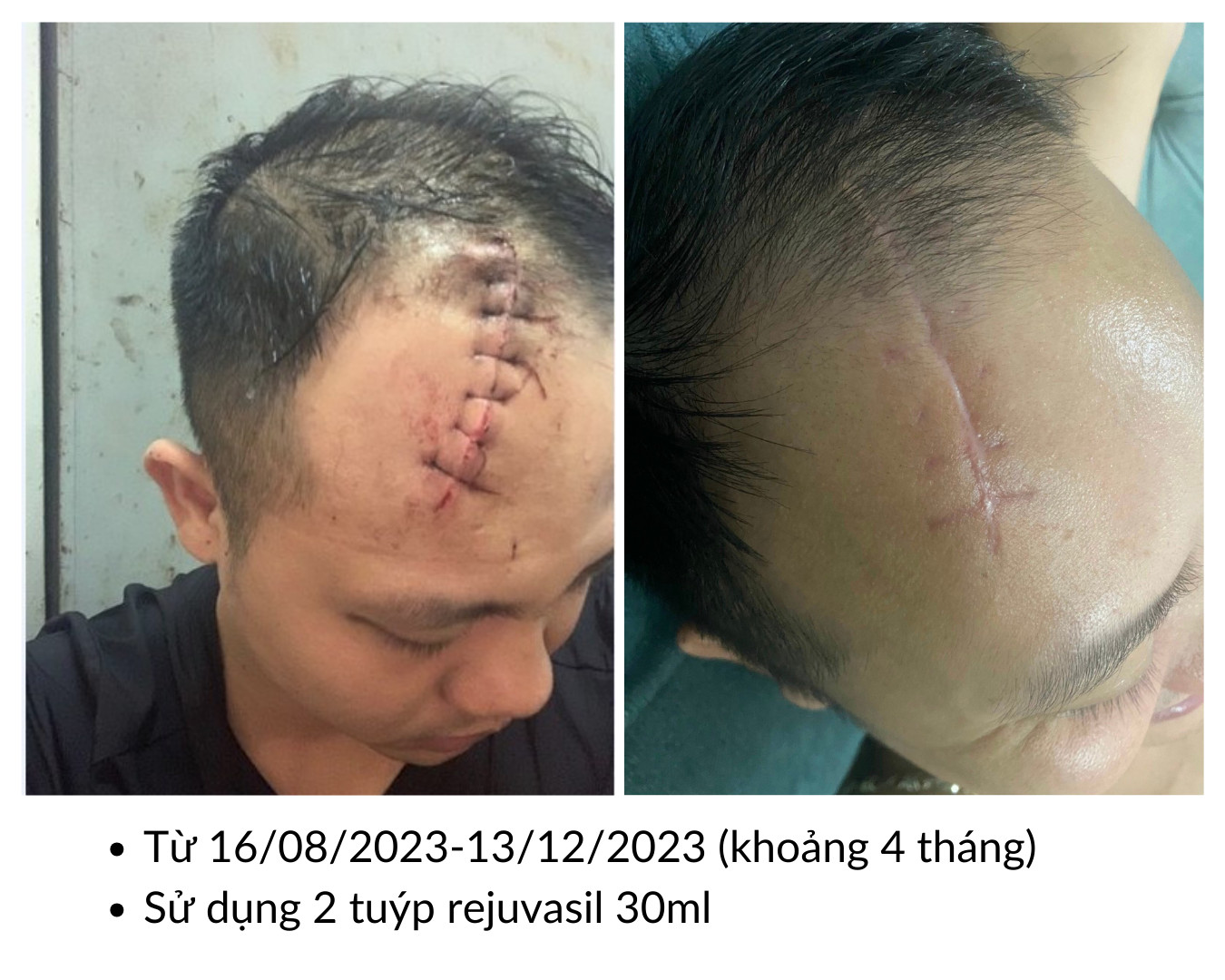 Hinh anh sau khi su dung Rejuvasil