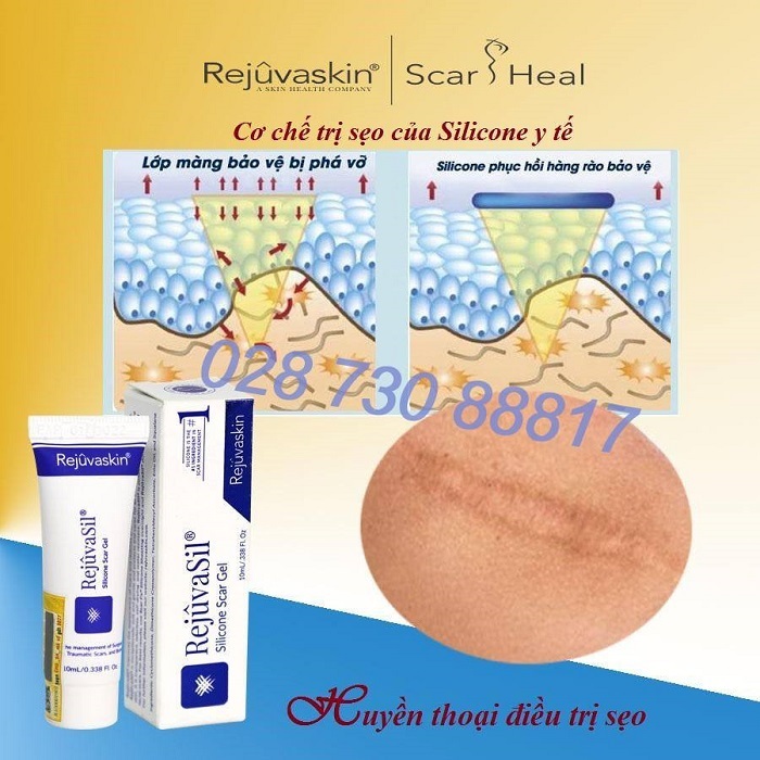 kem tri seo loi Rejuvasil