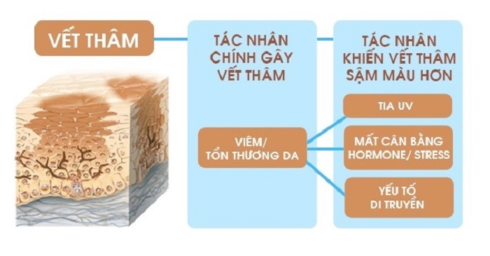 nguyen nhan gay seo tham