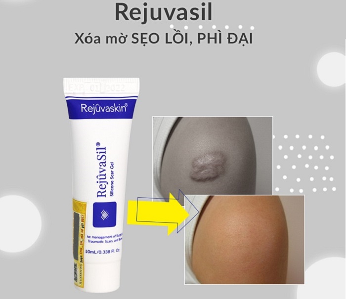 Kem làm mờ sẹo lồi Rejuvasil kem trị seo loi Rejuvasil
