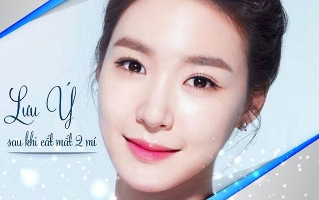 Lưu ý sau cát mí để ngừa sẹo Luu y sau cat mi de ngua seo
