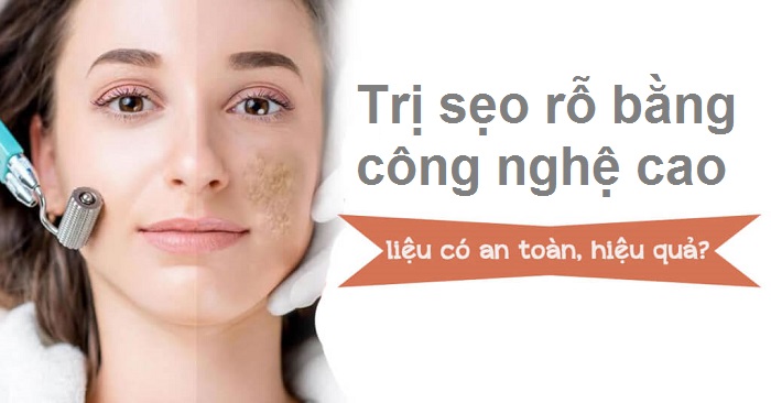 tri seo ro bang cong nghe hien dai