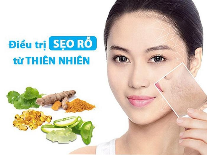 tri seo bang nguyen lieu thien nhien