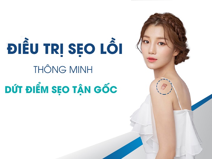 Bật mí 10 cách làm mờ sẹo lồi hiệu quả tận gốc ngăn ngừa tái phát 