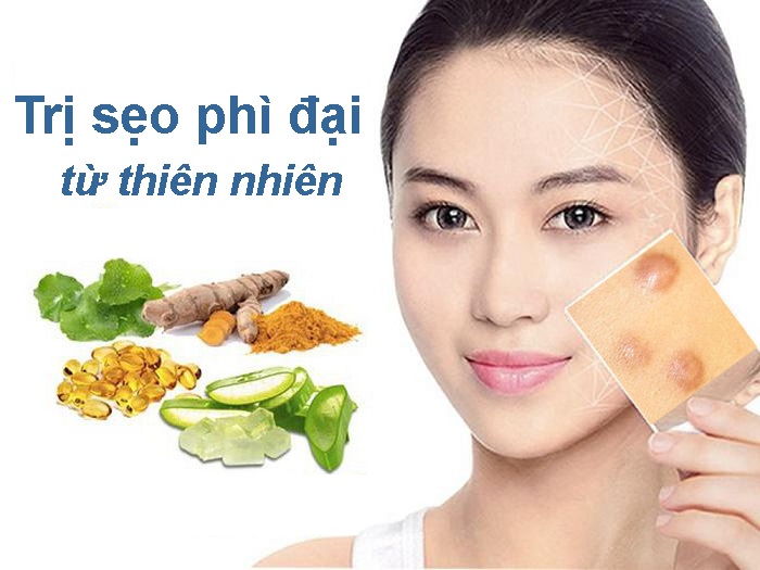 tri seo tu thien nhien