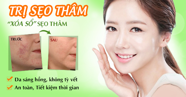 ​Kem làm mờ sẹo- giải pháp hiệu quả an toàn cho bạn