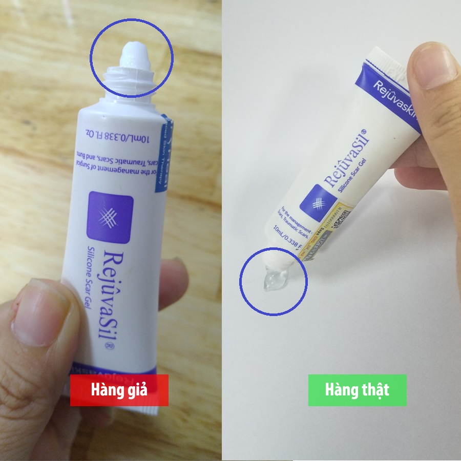 Scar Rejuvasil giả của fanpage hàng giả (bên trái) có màu trắng khác với sản phẩm gel xóa mờ sẹo Scar Rejuvasil chính hãng của Rejuvaskin/Scarheal 