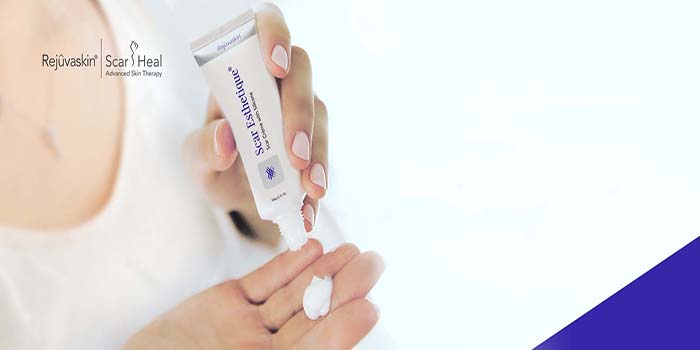  Kem làm mờ sẹo Scar Esthetique đẩy nhanh quá trình làm mờ, hết sẹo thâm