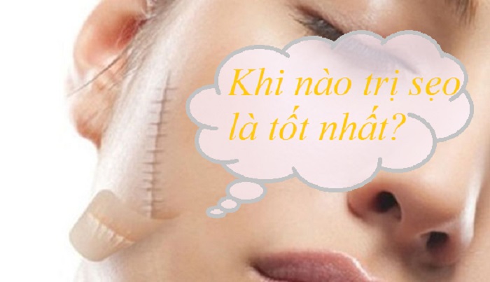 thoi gian tri seo khau