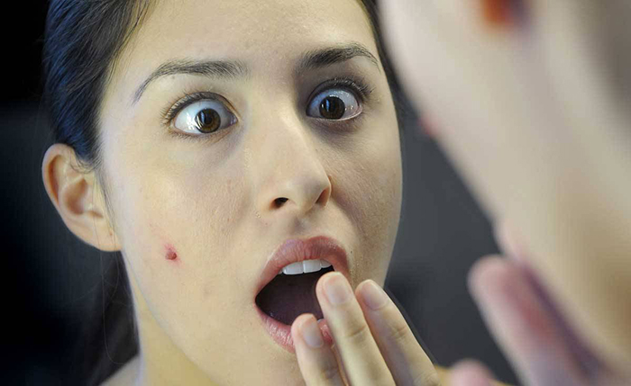 Khi người lớn bị bệnh thủy đậu rất có khả năng gây ra những biến chứng nghiêm trọng Khi người lớn bị bệnh thủy đậu rất có khả năng gây ra những biến chứng nghiêm trọng