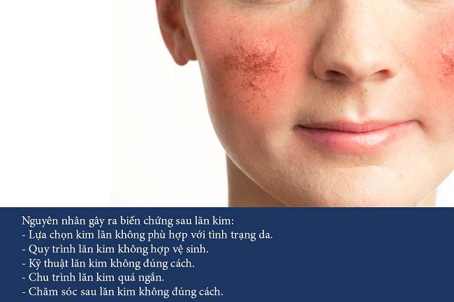 li do lam kim bi seo ro