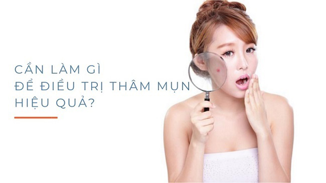 dieu can chu y khi tri seo tham