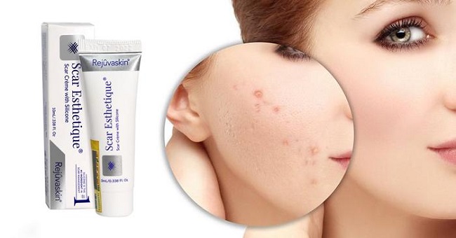 hieu-qua-kem-tri-seo-scar-esthetique