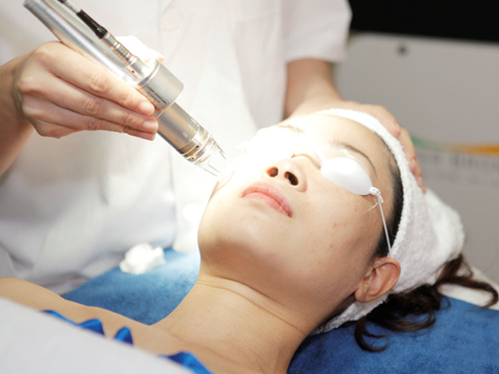 Trị sẹo bằng tia laser có mức chi phí tương đối cao