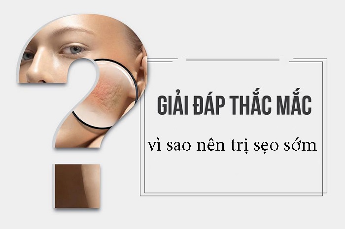 li do nen tri seo som