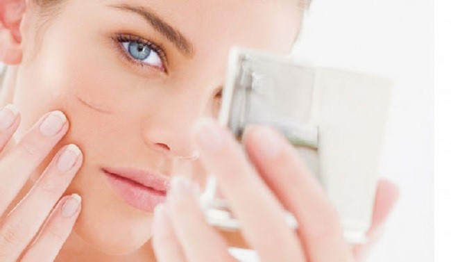 cach tri seo tai nha