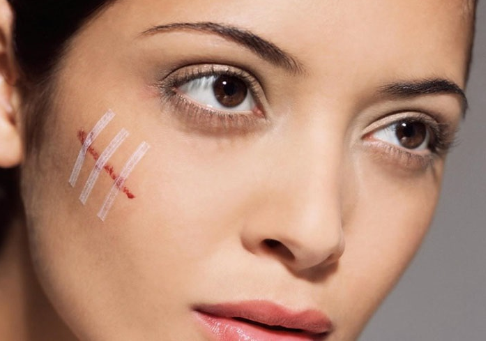 can tri seo kip thoi va dung cach