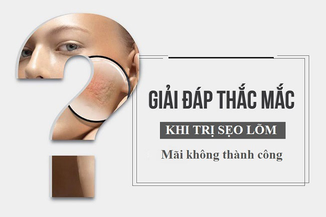 Luu y khi tri seo lom sau phau thuat