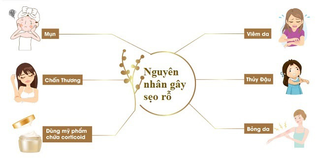 nguyên nhân gây sẹo rỗ nguyen nhan gay seo ro