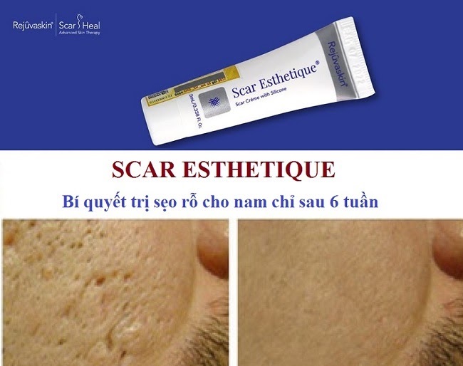 ket qua tri seo ro bang kem Scar Esthetique