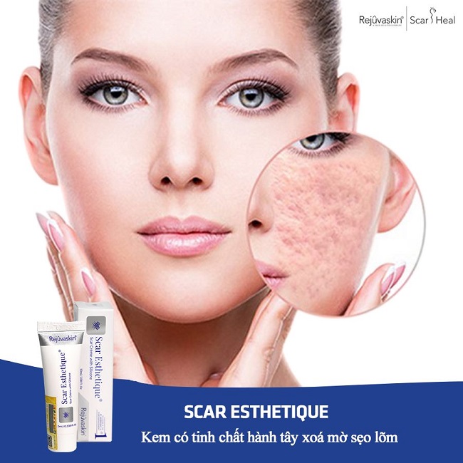 kem-tri-seo-scar-esthetique-cua-my