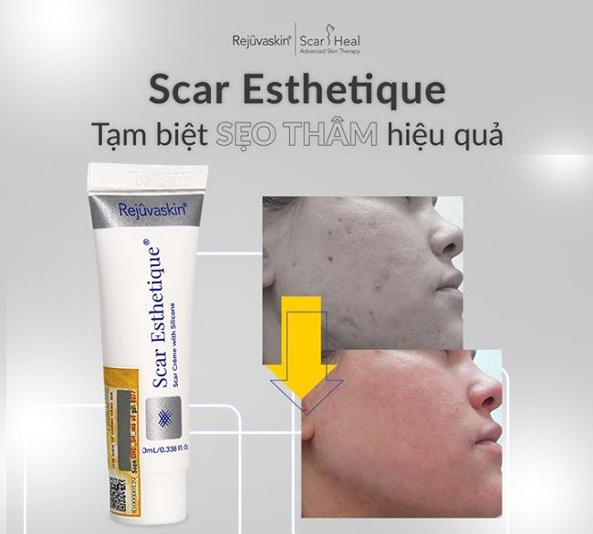 kem tri seo tham Scar Esthetique