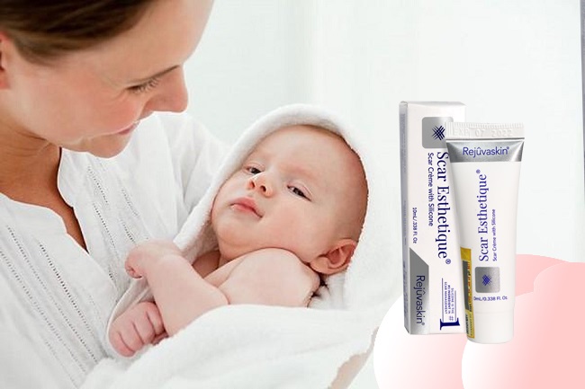 kem làm mờ sẹo thâm cho bé Scar Esthetique tri seo tham cho be bang Scar Esthetique