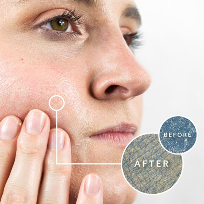 Những thay đổi trước và sau khi sửa dụng sữa rửa mặt Rejuvaskin|Scar Heal