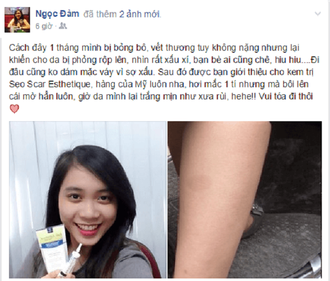 ket qua tri seo bong