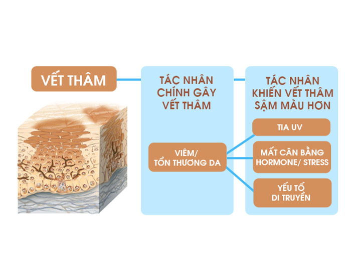 nguyên nhân dẫn đến thâm mụn ở mặt