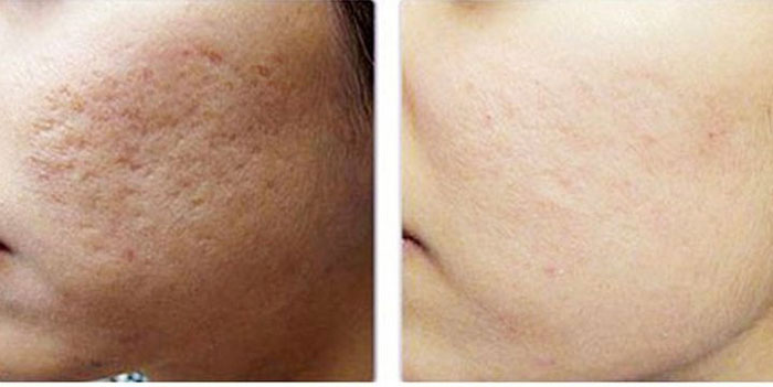 Hiệu quả khi sử dụng 