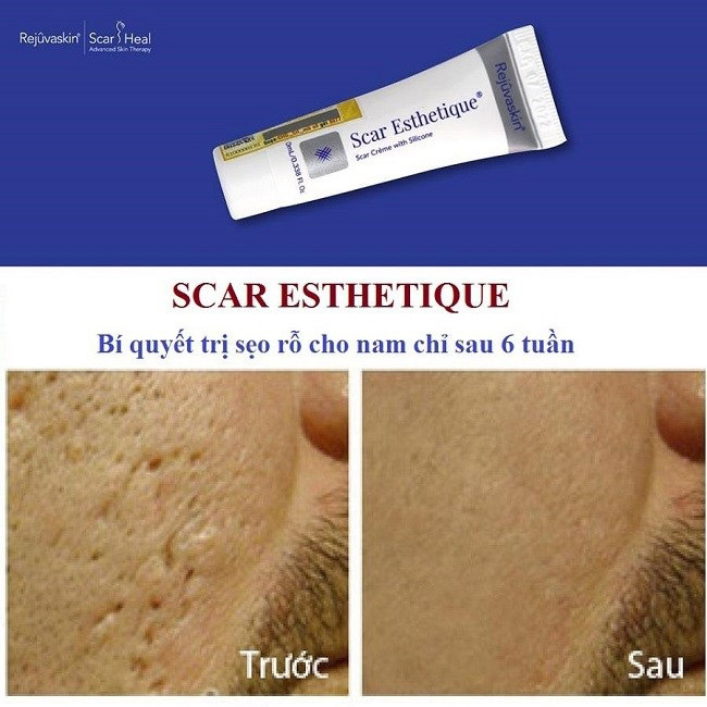 kem tri seo Scar Esthetique