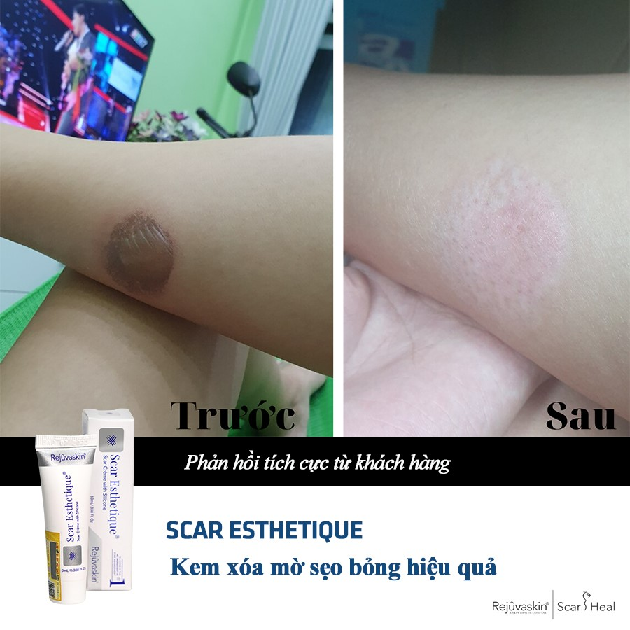 Kem làm mờ sẹo mua nhiều nhất 