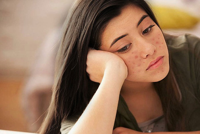 Làm thế nào làm mờ sẹo nhanh cho cô nàng hậu đậu? Làm thế nào làm mờ sẹo nhanh cho cô nàng hậu đậu?