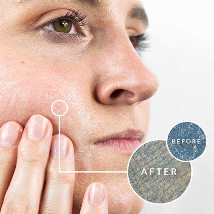 Ô nhiễm môi trường gây nhiều tác hại cho làn da của bạn  Ô nhiễm môi trường gây nhiều tác hại cho làn da của bạn