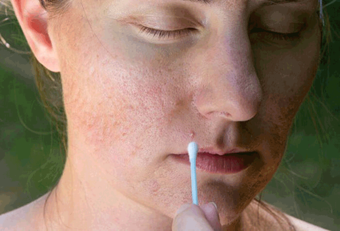 Seo la nhan to gay mat tham my am anh nhat doi voi phai dep