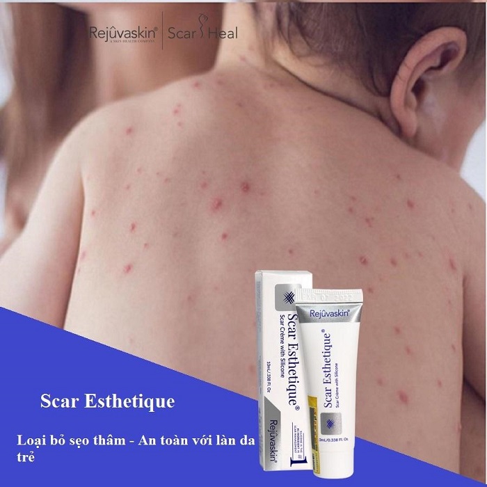 kem tri seo Scar Esthetique