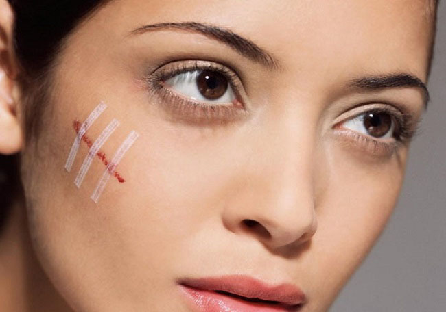 cach tri seo lom do tai nan