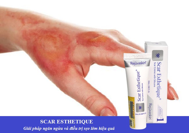 kem tri sẹo lom scar esthetique