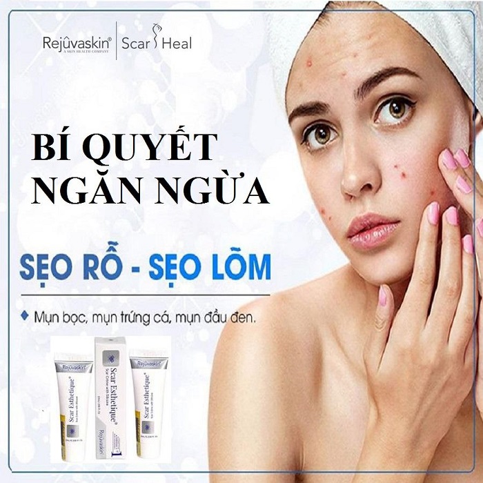 cach tri seo ro bang Scar Esthetique