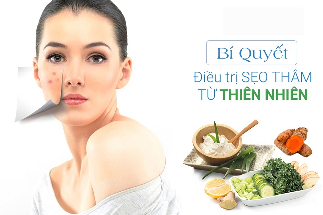 cach tri seo tham tu thien nhien