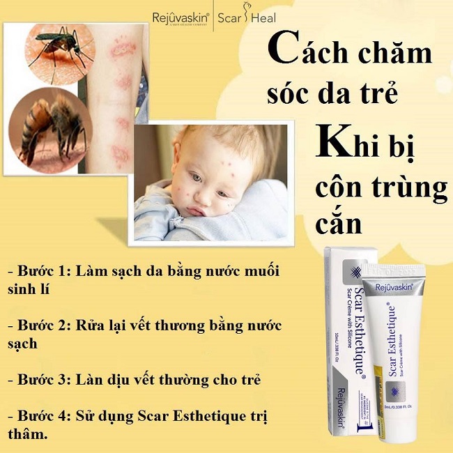 Kem làm mờ sẹo thâm Scar Esthetique kem tri seo tham Scar Esthetique