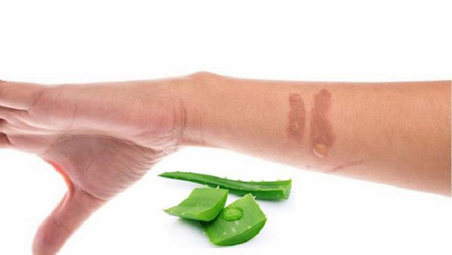 Tri thâm sau bong bang nha dam