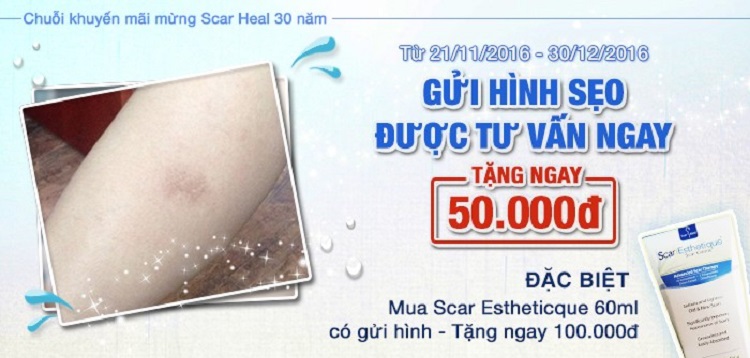 khuyen mai mung Scar Heal 30 phat trien
