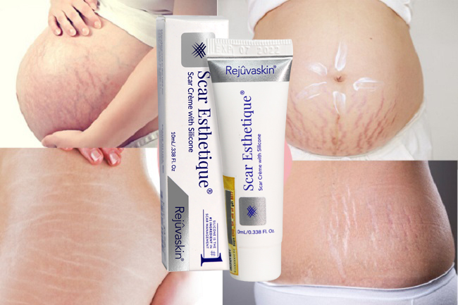 kem tri seo tham Scar Esthetique