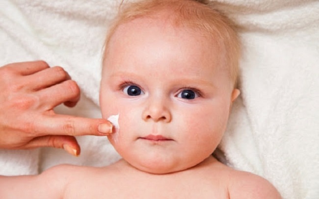 Kem làm mờ sẹo thâm cho bé có an toàn không? Kem làm mờ sẹo thâm cho bé có an toàn không?