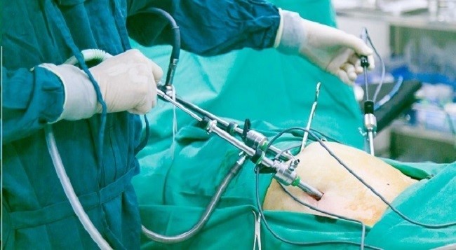 Phẫu thuật nội soi có để lại sẹo?