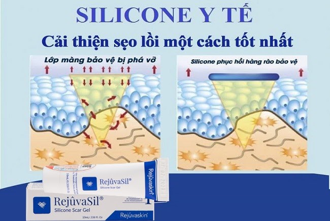 thành phần kem làm mờ sẹo phì đại